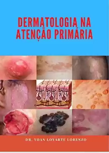 Livro PDF: Dermatologia Na Atenção Primária