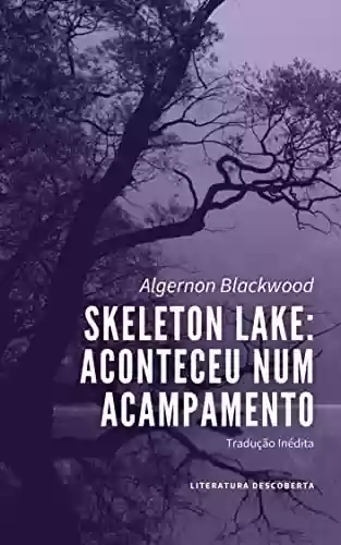 Livro PDF: Skeleton Lake: Aconteceu num Acampamento