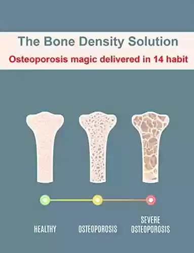 Livro PDF The Bone Density Solution: Osteoporosis magic delivered in 14 habit (English Edition)