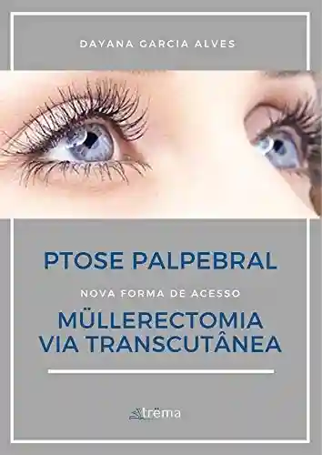 Livro PDF: Müllerectomia via Transcutânea: Ptose Palpebral (1)